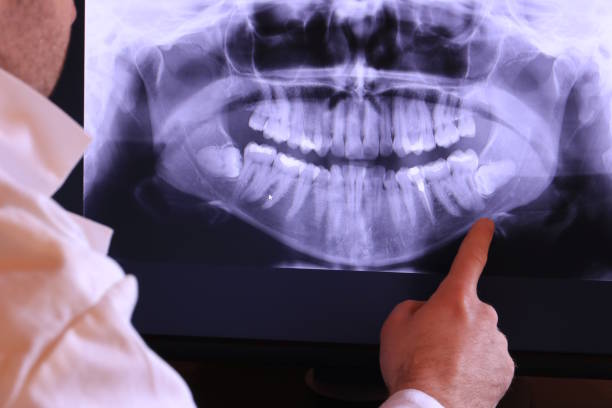 Best Emergency Denture Repair in Shrewsbury, MO
