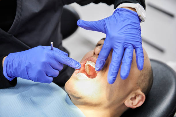 Best Emergency Tooth Extraction in Shrewsbury, MO